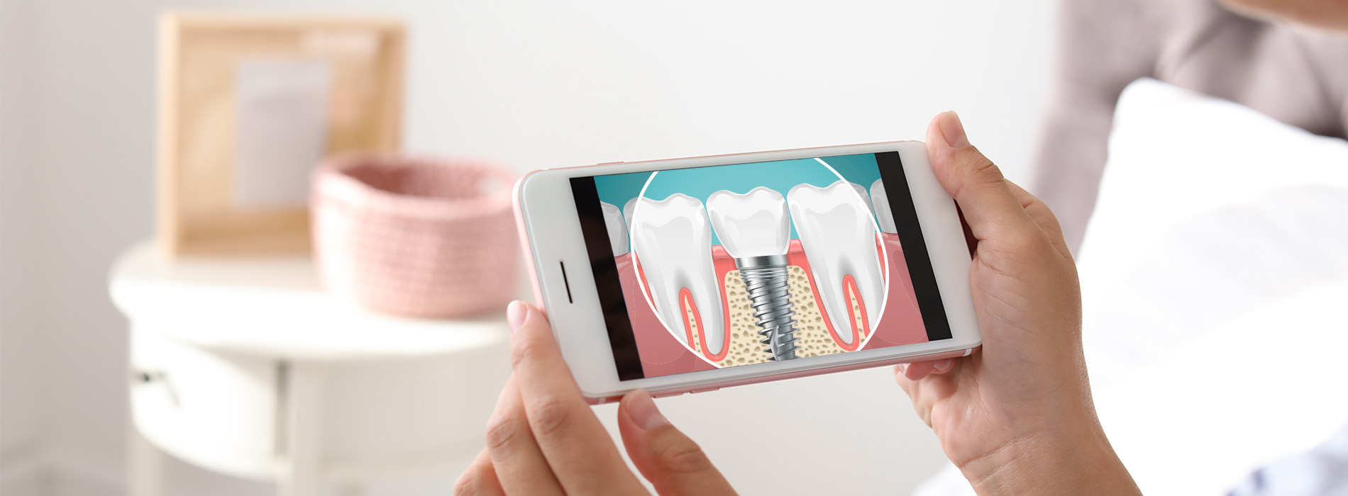 Sharp Dentistry | Teeth Whitening, Dental Lab and All-on-6 reg 