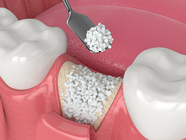 Sharp Dentistry | Night Guards, Cosmetic Dentistry and Digital Radiography