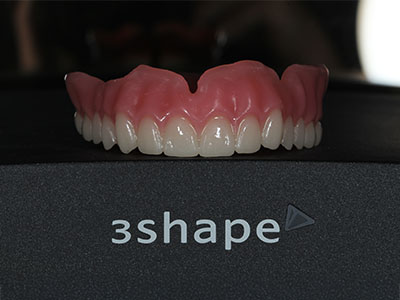 Sharp Dentistry | Implant Dentistry, Oral Exams and Night Guards