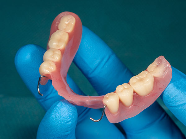 Sharp Dentistry | Veneers, Digital Radiography and Fluoride Treatment