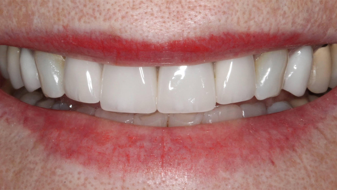 Sharp Dentistry | All-on-6 reg , Sleep Apnea and Implant Dentistry
