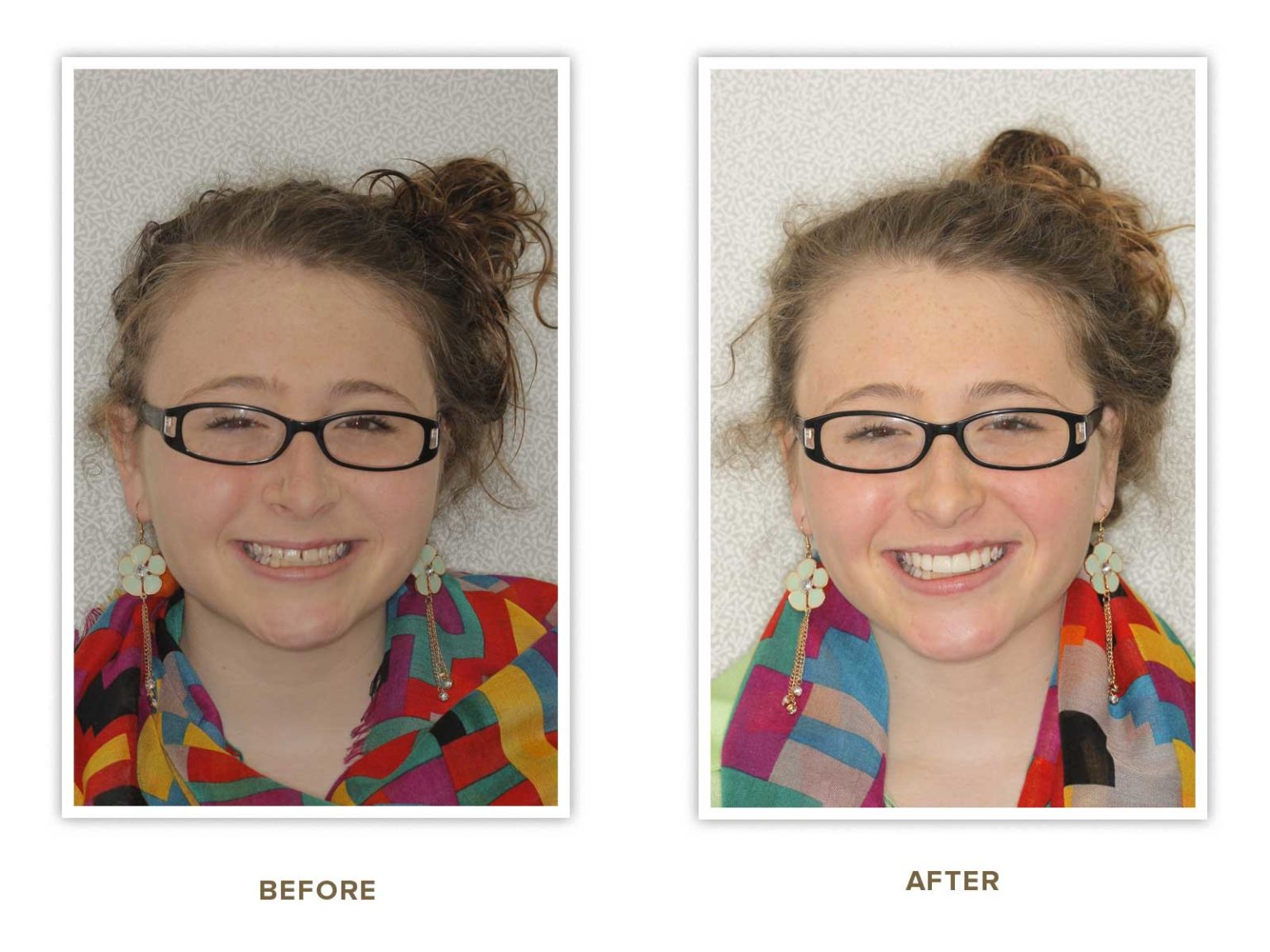 Sharp Dentistry | Digital Impressions, All-on-4 reg  and TMJ Disorders