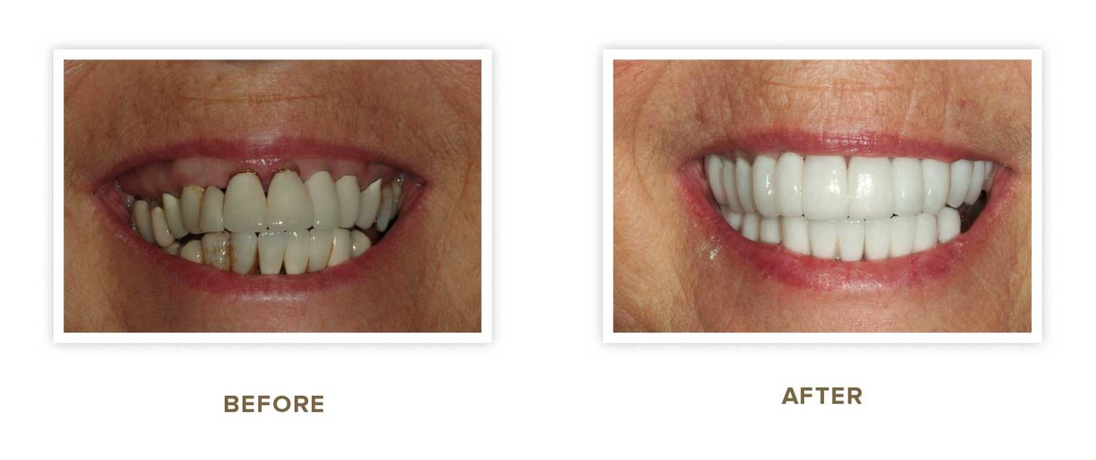 Sharp Dentistry | Implant Restorations, Intraoral Camera and All-on-4 reg