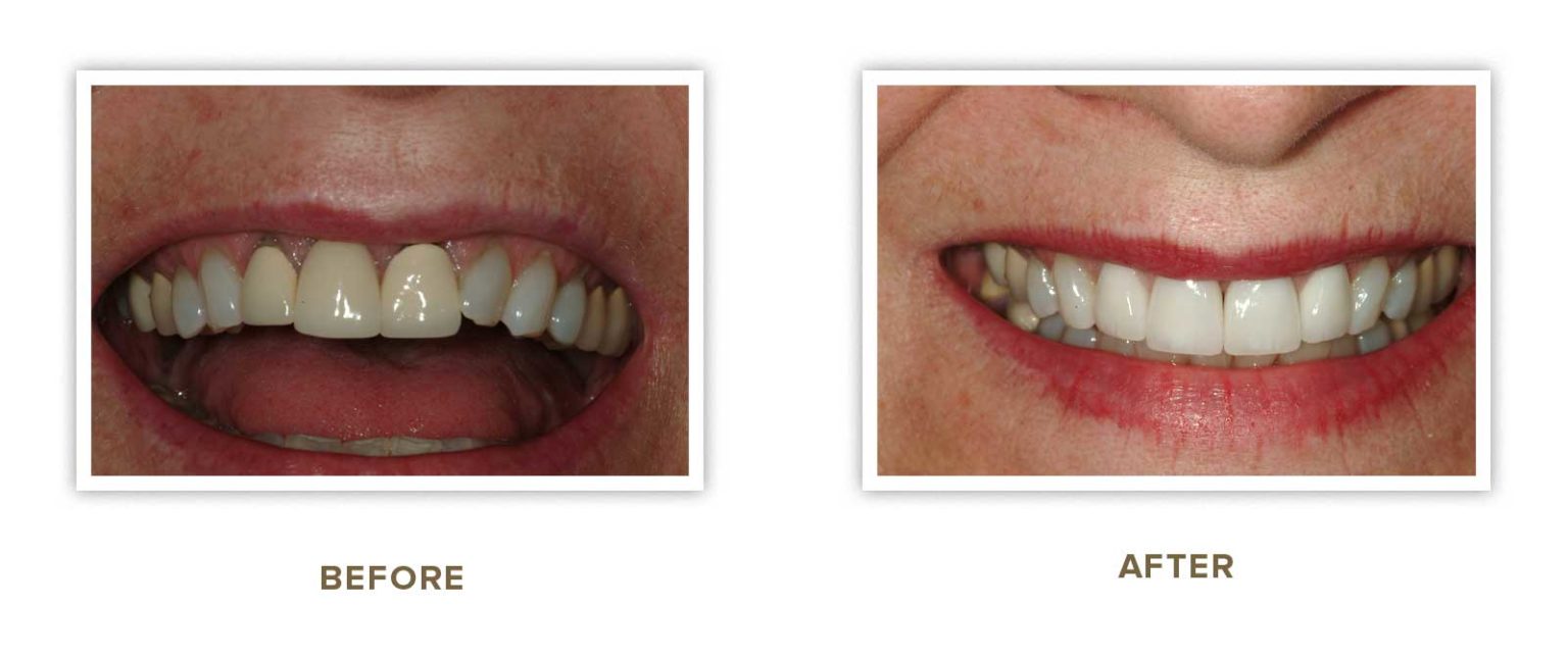 Sharp Dentistry | Full Mouth Reconstruction, All-on-4 reg  and Sleep Apnea