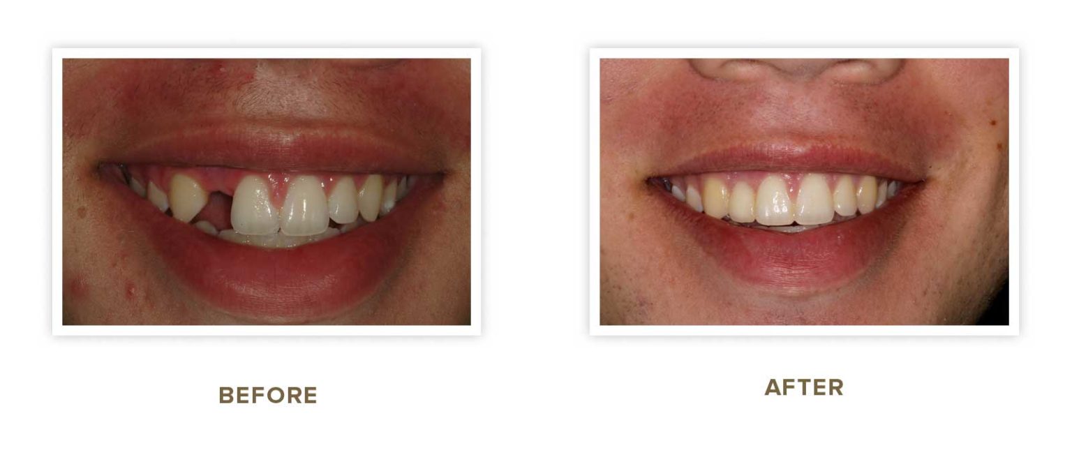 Sharp Dentistry | Digital Impressions, Oral Exams and Sports Mouthguards