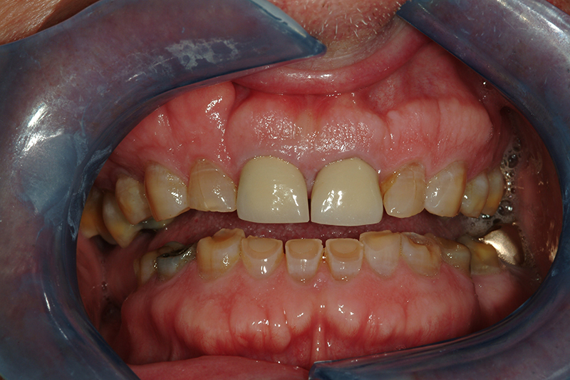 Sharp Dentistry | Bone Grafting, Cosmetic Dentistry and Snoring Appliances