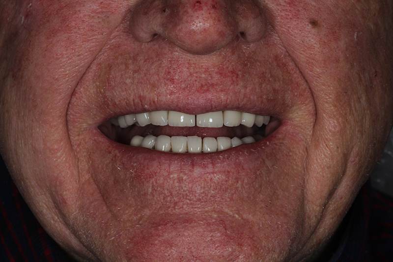 Sharp Dentistry | Dental Bridges, Sinus Augmentation and Pediatric Dentistry