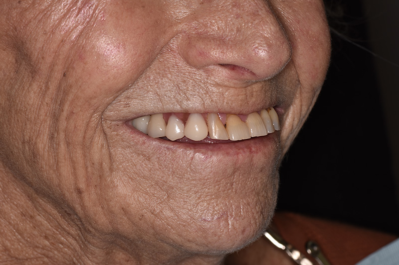 Sharp Dentistry | Emergency Treatment, Dentures and Full Mouth Reconstruction
