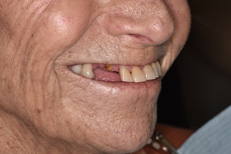 Sharp Dentistry | Sleep Apnea, CBCT and Ceramic Crowns