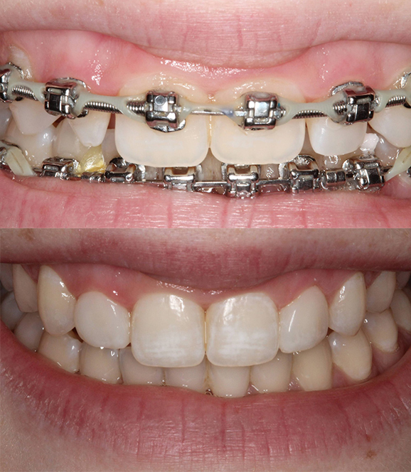 Sharp Dentistry | Snoring Appliances, Cosmetic Dentistry and Full Mouth Reconstruction