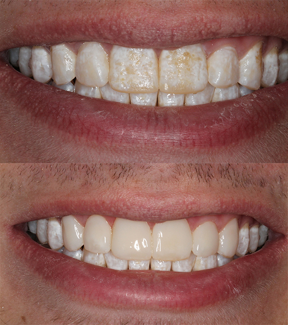 Sharp Dentistry | TMJ Disorders, Pediatric Dentistry and All-on-4 reg 