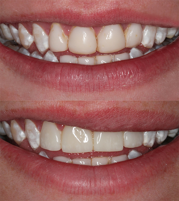 Sharp Dentistry | Full Mouth Reconstruction, Snoring Appliances and Teeth Whitening