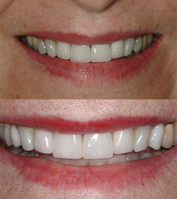 Sharp Dentistry | Dentures, Teeth Whitening and Cosmetic Dentistry