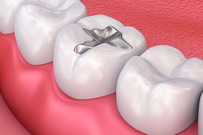Sharp Dentistry | Pediatric Dentistry, Cosmetic Dentistry and Implant Restorations