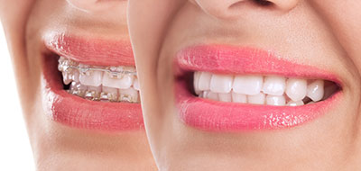 Sharp Dentistry | Dental Cleanings, Sports Mouthguards and Implant Restorations