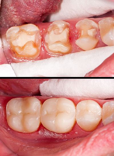 Sharp Dentistry | Pediatric Dentistry, Intraoral Camera and Night Guards