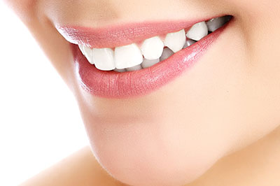 Sharp Dentistry | Preventative Program, Intraoral Camera and Fluoride Treatment