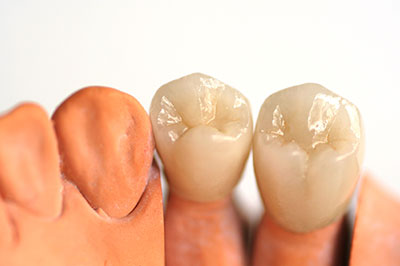 Sharp Dentistry | Veneers, Intraoral Camera and Sports Mouthguards