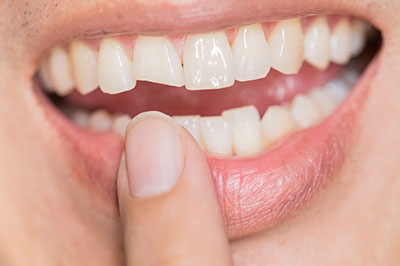 Sharp Dentistry | Periodontal Treatment, Oral Exams and Night Guards