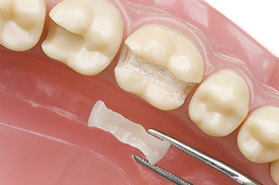 Sharp Dentistry | TMJ Disorders, All-on-6 reg  and Dentures