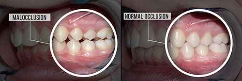 Sharp Dentistry | Veneers, CBCT and Implant Dentistry