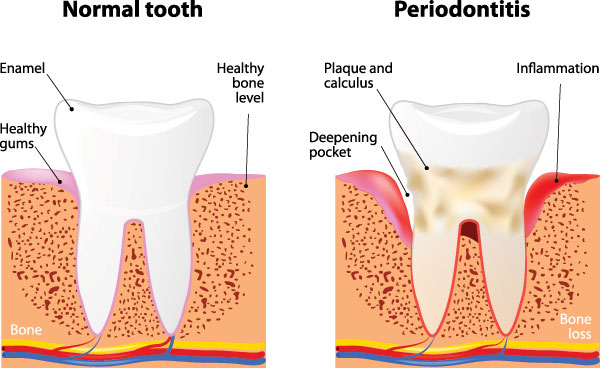 Sharp Dentistry | TMJ Disorders, Veneers and Pediatric Dentistry