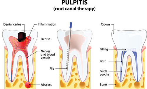 Sharp Dentistry | Dental Bridges, Crowns and Intraoral Camera