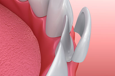 Sharp Dentistry | Crowns, Inlays  amp  Onlays and CBCT