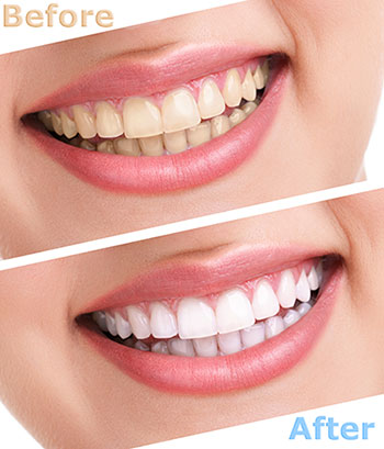 Sharp Dentistry | Dental Lab, Sleep Apnea and CBCT