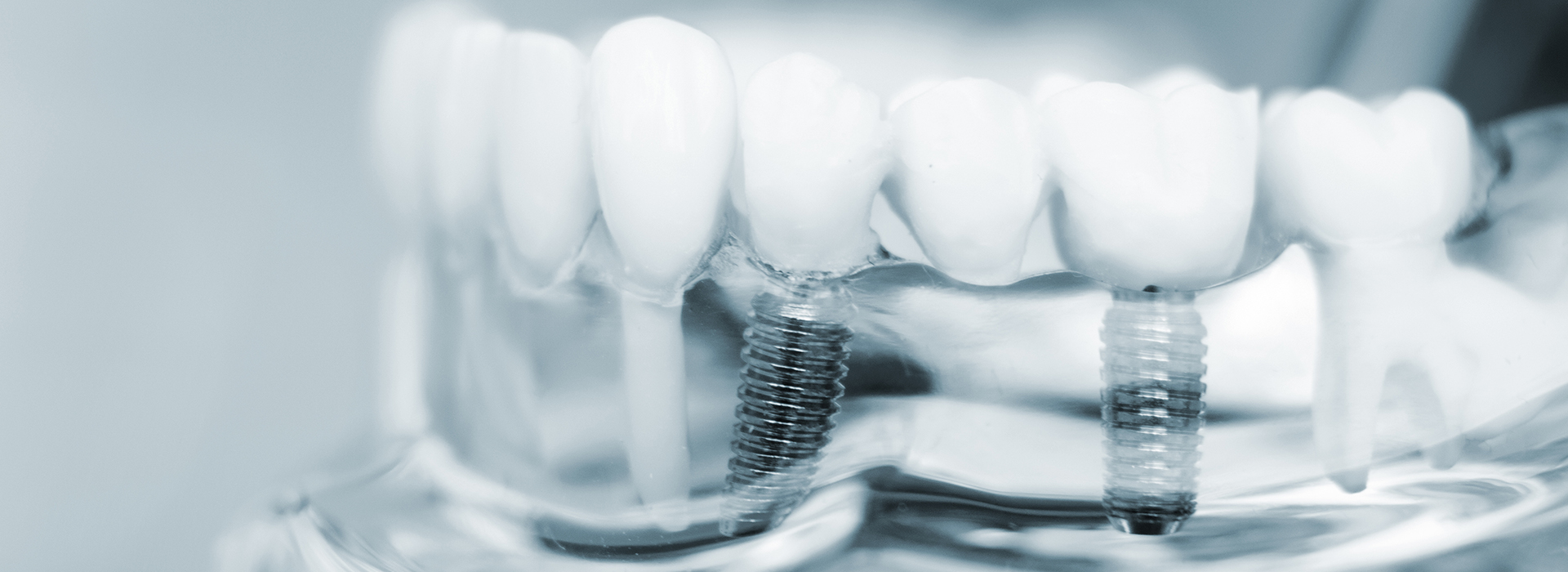 Sharp Dentistry | Sports Mouthguards, Pediatric Dentistry and Intraoral Camera