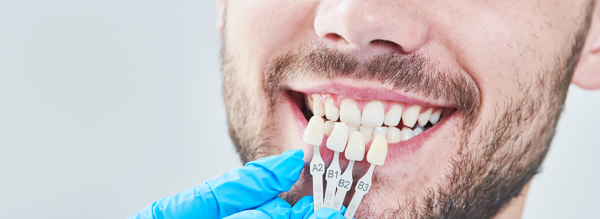 Sharp Dentistry | Inlays  amp  Onlays, Ceramic Crowns and Digital Radiography